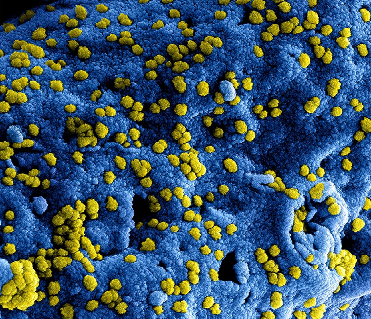 Africa CDC Reaffirms Support to Kenya Following Confirmation of Four Additional Ebola Cases