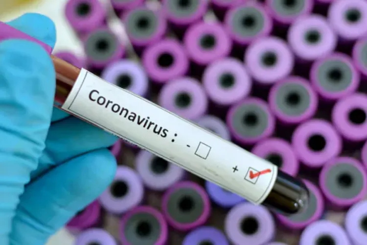 Nigeria Confirms Second Coronavirus Case