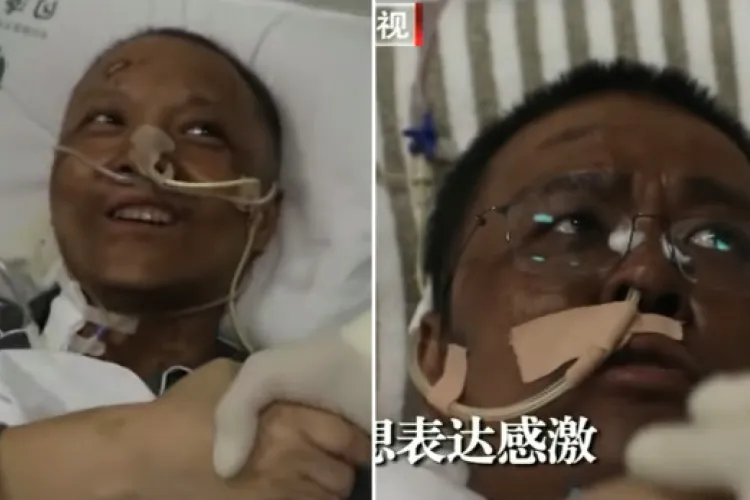 Chinese Doctors' Skin Color Turn Black after Recovering from Covid-19