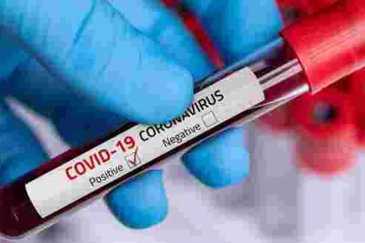 Covid-19 May be Transmitted Through Sex, Study Shows 