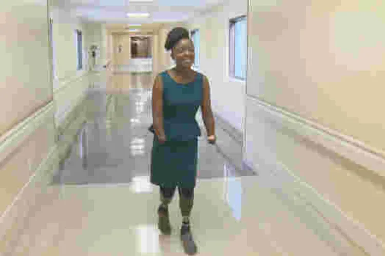 How Victoria Mugo, a Kenyan Woman in the US, Lost All Her Hands and Legs 