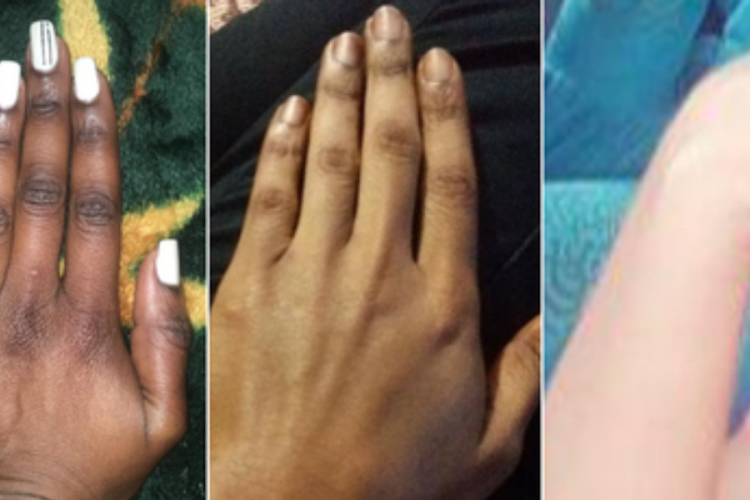 Kenya Battles Skin Bleaching Trend Despite Ban on 400 Dangerous Cosmetics