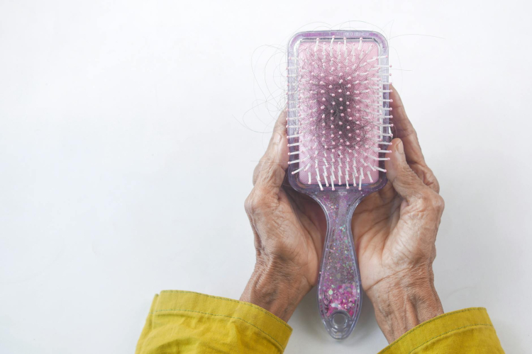 Breakthroughs in Hair Loss Treatment Offer New Hope for Women Globally