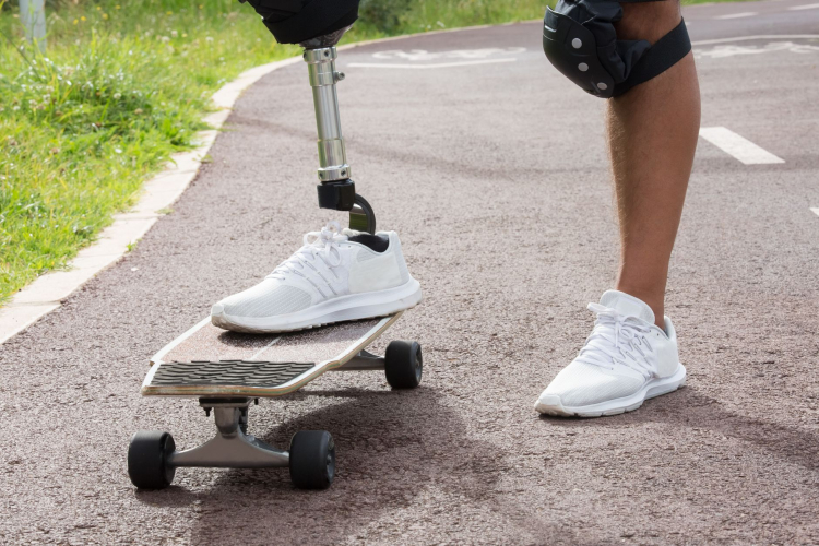 Innovative Prosthetics Testing Paves the Way for Global Medical Advancements