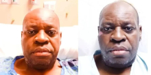 Kenyan Man in US Appeals for Support as Cancer Reaches Stage Four