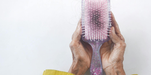 Breakthroughs in Hair Loss Treatment Offer New Hope for Women Globally