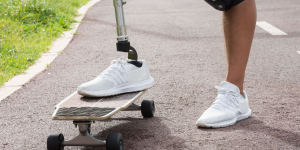 Innovative Prosthetics Testing Paves the Way for Global Medical Advancements
